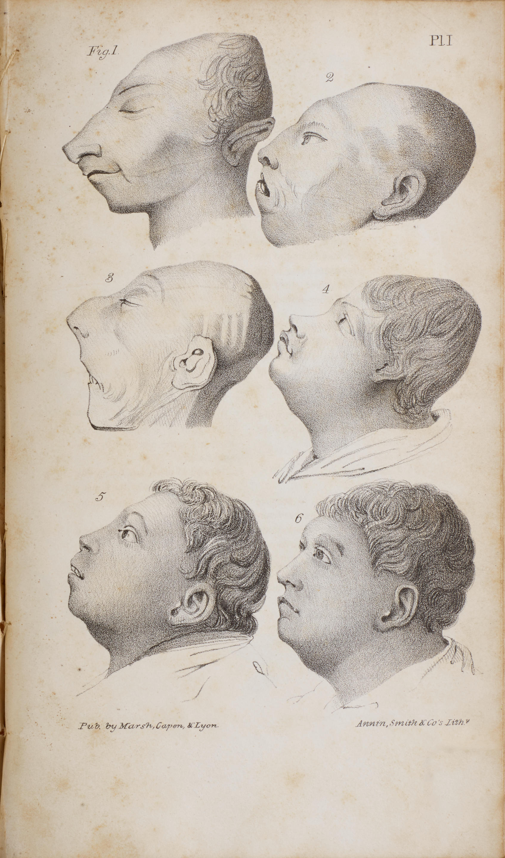 SPURZHEIM JOHANN GASPAR 1776 1832 Observations on the Deranged Manifestations